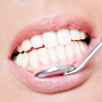 Healthy smile during dental exam