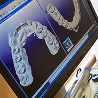 Digital dental impressions on computer screen