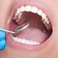 Closeup of smile during dental treatment