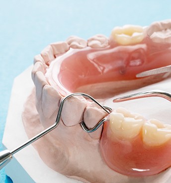 closeup of partial dentures on cast mold