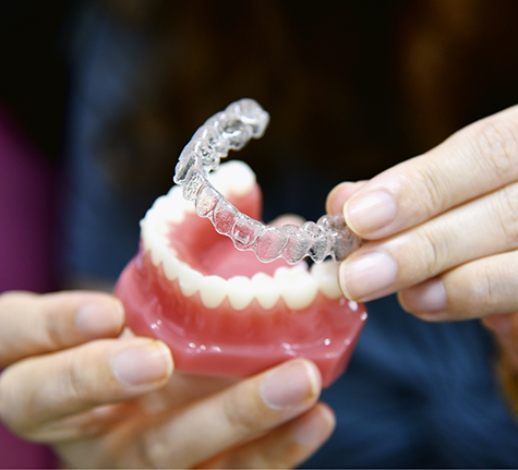 Dentist placing an Invisalign clear aligner over a model of the teeth