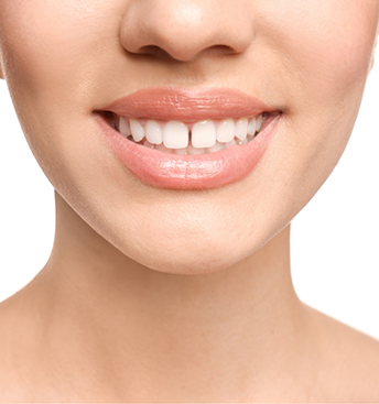 Person smiling with a gap between their two front teeth