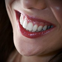 Closeup of healthy teeth and gums