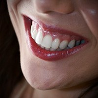 Closeup of healthy teeth and gums