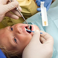 Child receiving fluoride treatment in Melrose, MA