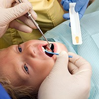 Child receiving fluoride treatment