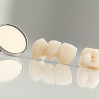 Dental crown and bridge restorations before placement