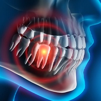 Digital image of a highlighted toothache 