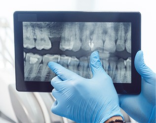 Dental x-rays on tablet computer