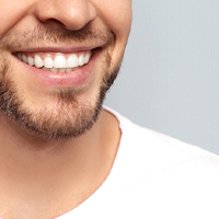 A man’s beautiful teeth after getting a smile makeover in Winthrop 