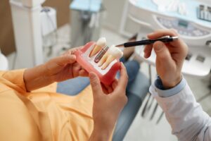 Dentist pointing to a dental implant encased in a mold